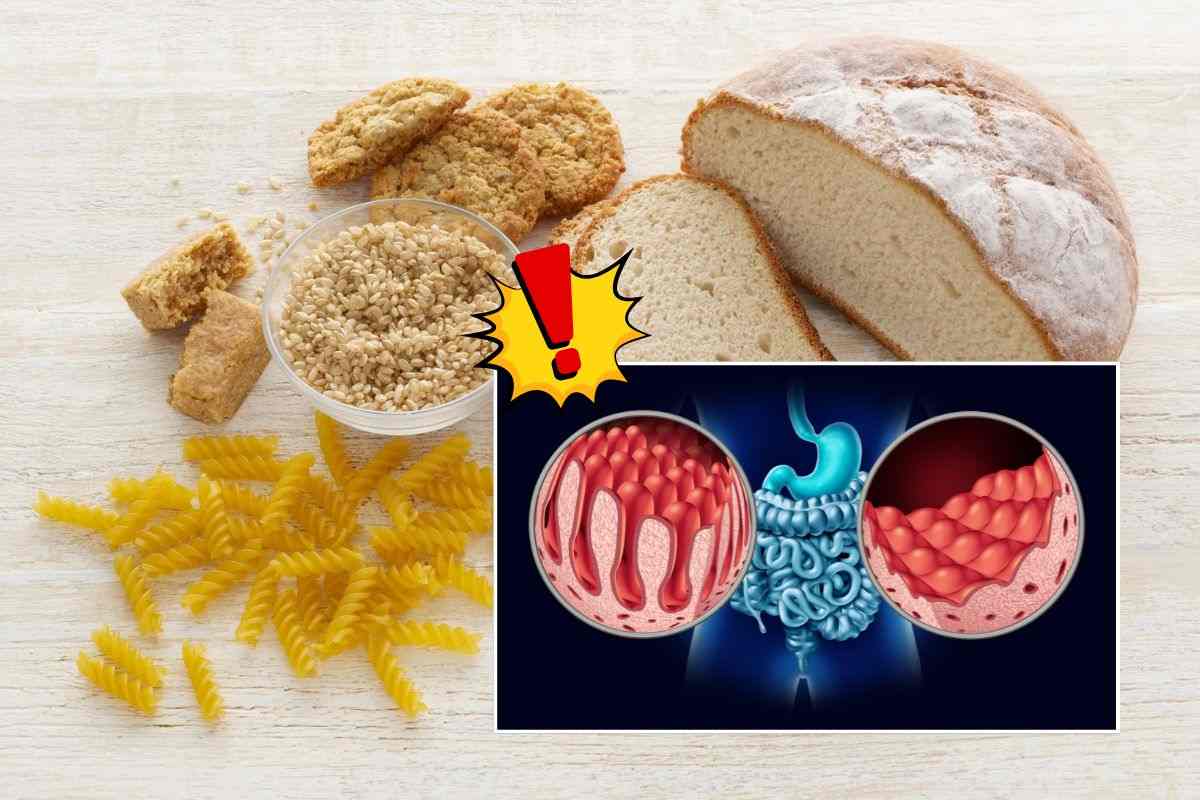 I cibi contenenti glutine come pane pasta e cereali