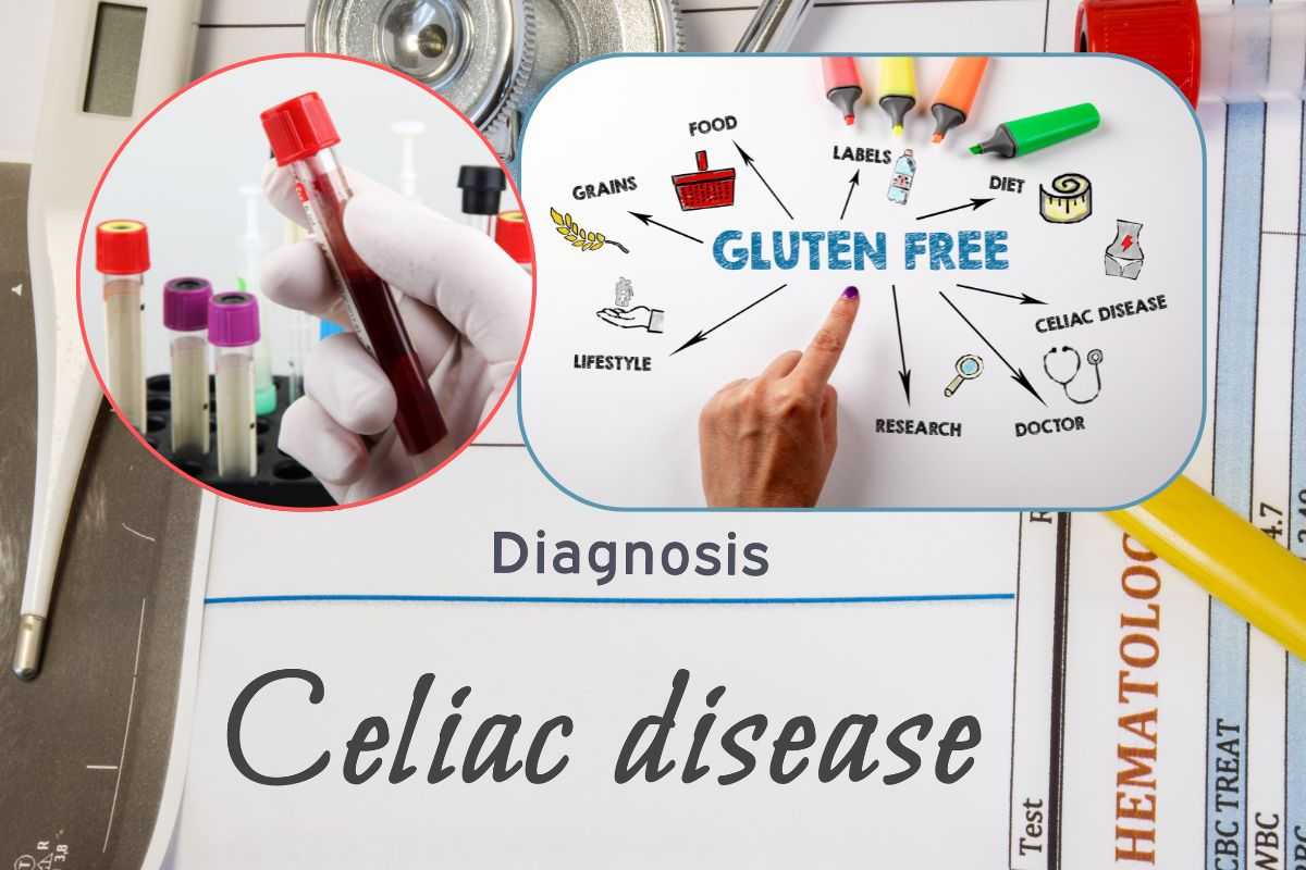 Gluten free per vivere sereni